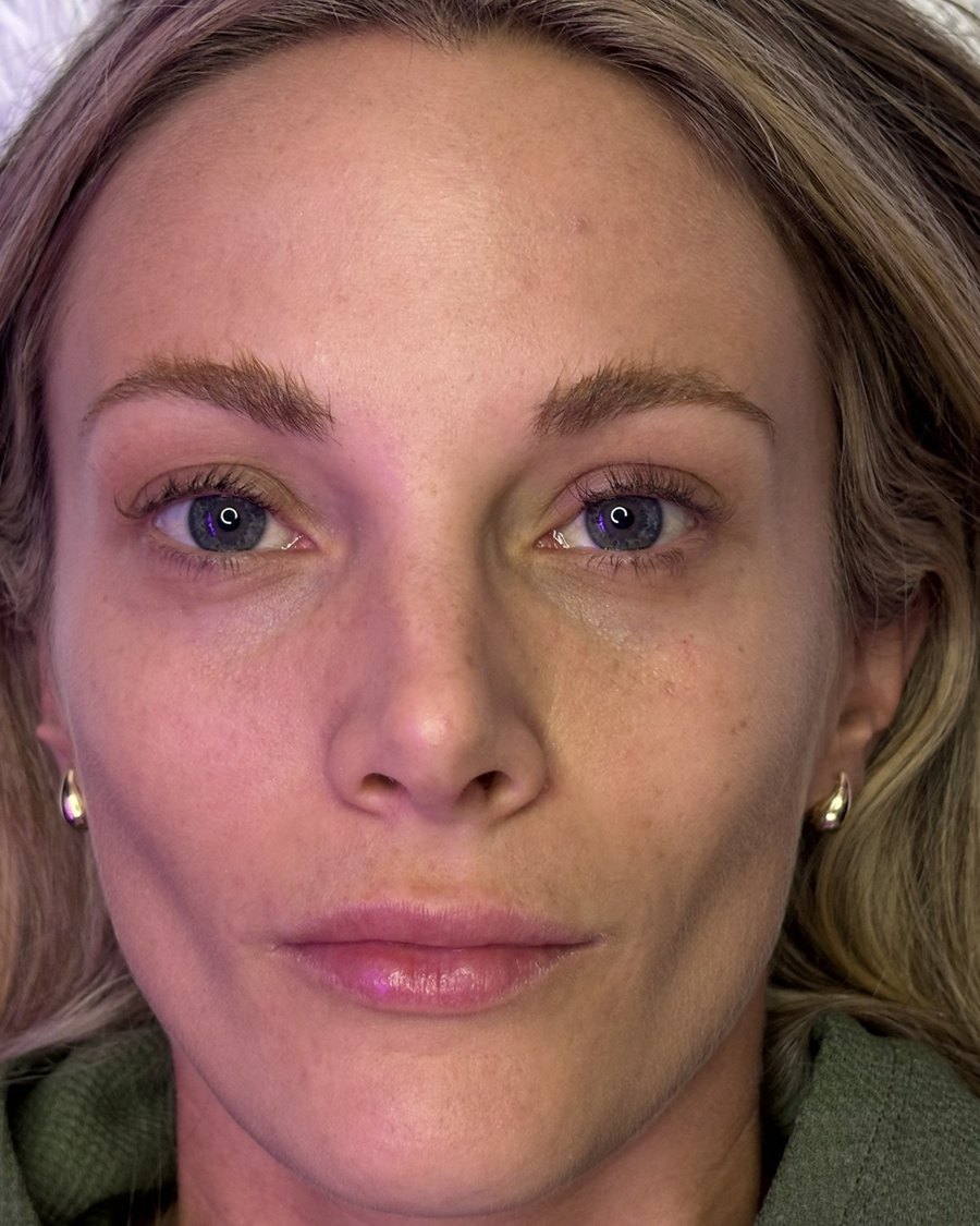 Lash lift before